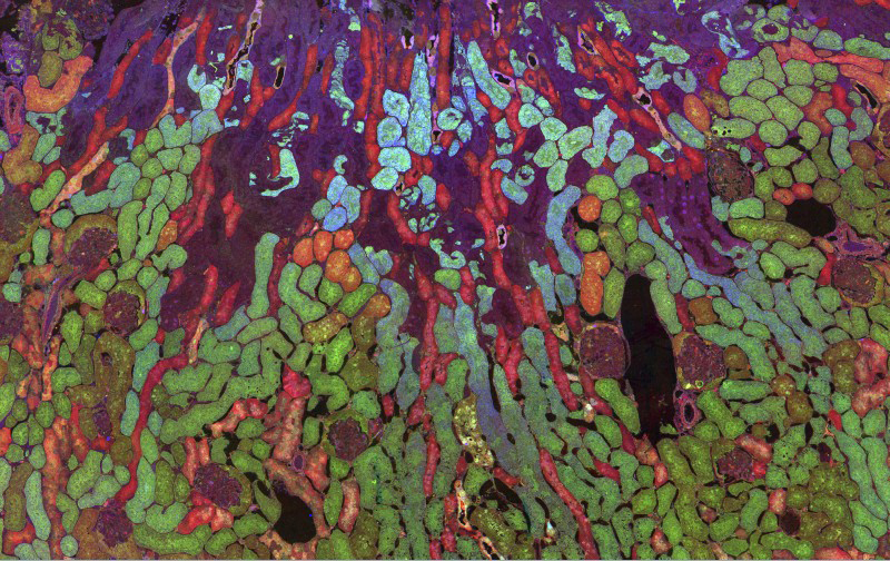 Distribution of metabolites in a mouse kidney