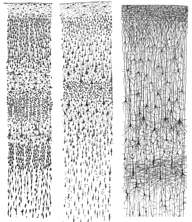 Triptych of black and white brain illustrations.