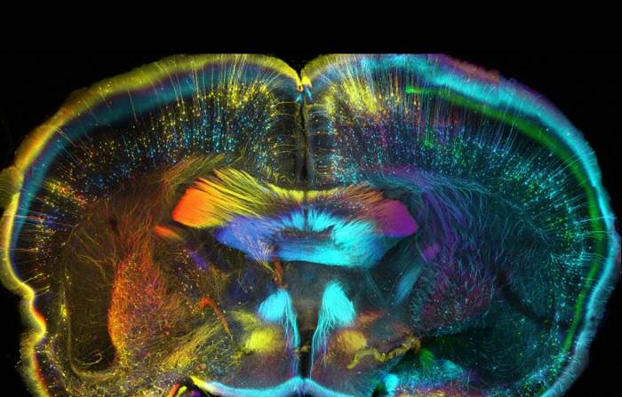 Multicolored cross section of the human brain