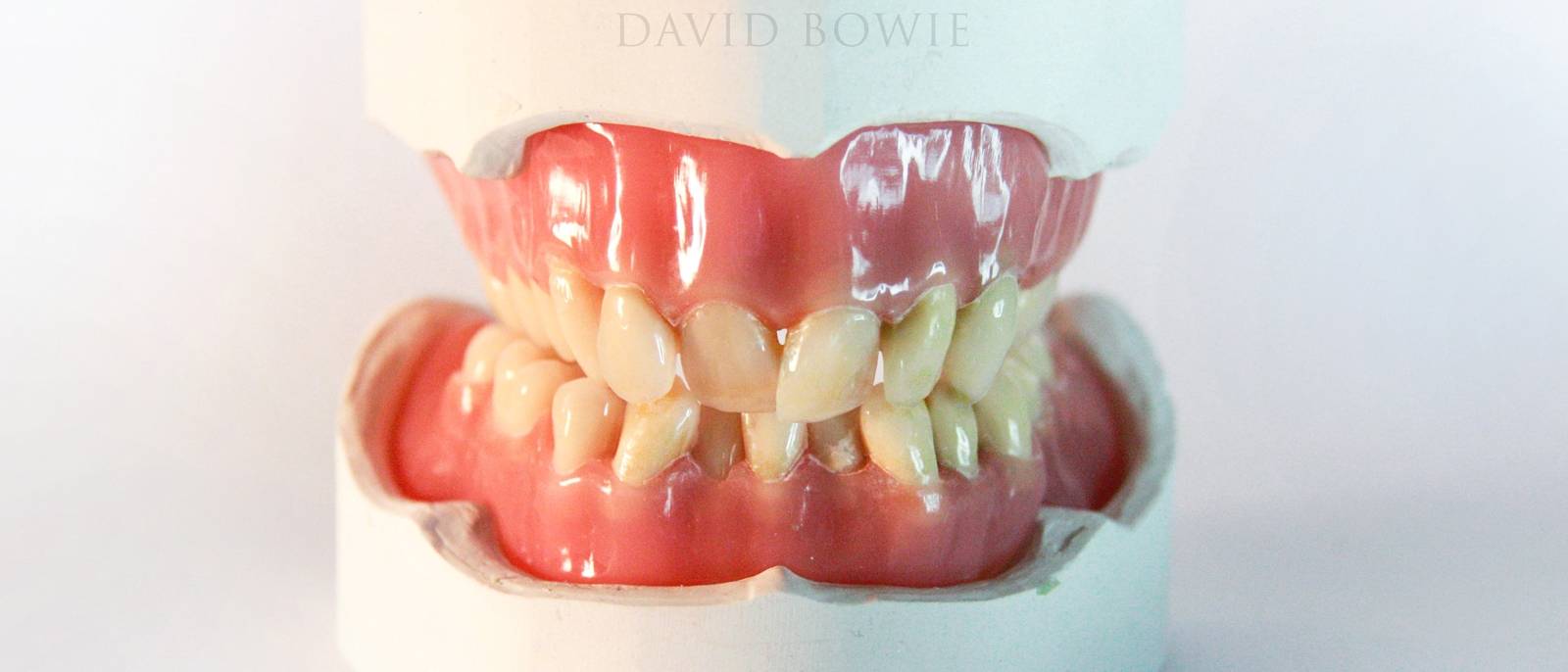 Artist Makes A Sculpture Of David Bowie's Original Teeth Faena
